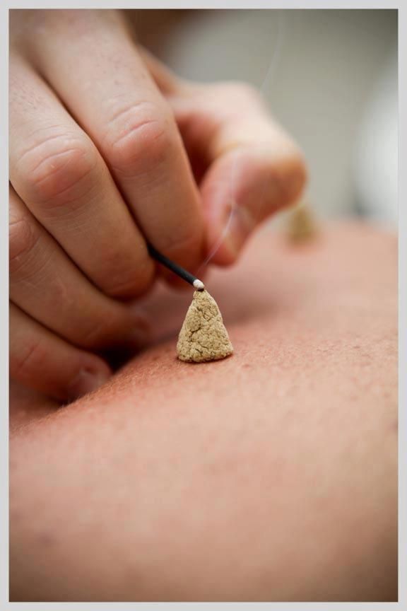 La Moxibustión: El Calor que alivia, restaura y mejora tu Vitalidad